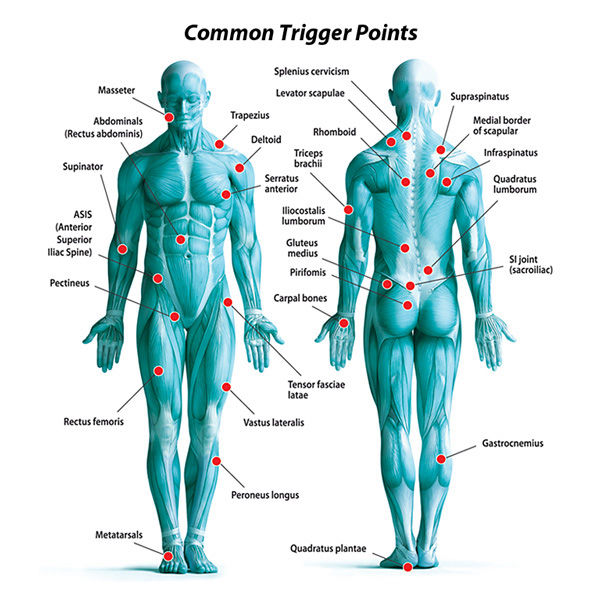 Trigger Point